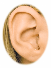 Picture of In the ear hearing aid completely in the ear