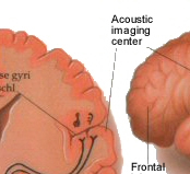 acoustic centres in the cerebral cortex