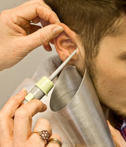 ear wax removal Edinburgh