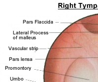 Right Tympanic Membrane