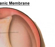 Right Tympanic Membrane